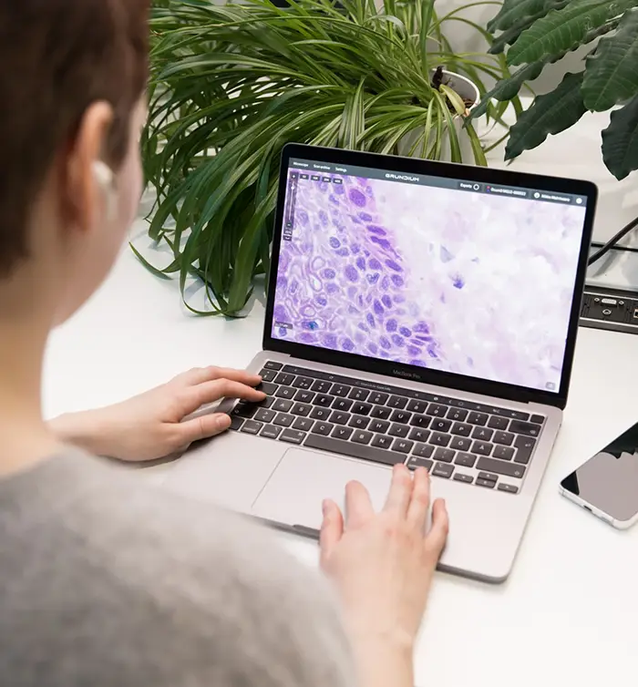 Boosting diagnostic speed and accuracy in labs with digital pathology